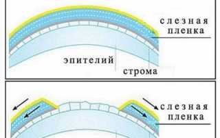 Систейн Ультра – инструкция по применению, отзывы про глазные капли, дешевые аналоги