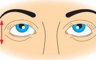 Что такое пальминг для глаз, и как его делать