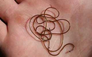 Какие осложнения вызывает паразит конский волос