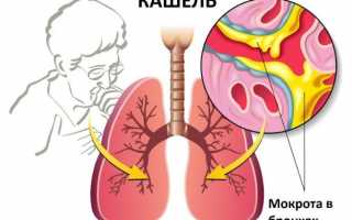 Как сухой кашель сделать влажным: способы, препараты и народные средства