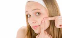 Грибок на лице: симптомы и методы лечения