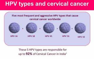 Чем опасен ВПЧ 31 типа?