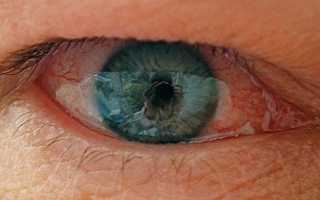 Глазные капли Фотил для лечения глаукомы