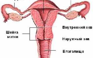 Причины формирования несостоятельного рубца на матке после кесарева сечения