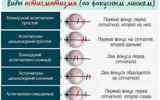 Дальнозоркость и астигматизм у детей – причины и лечение ребенка