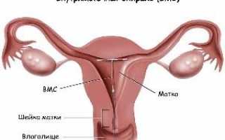 Когда можно ставить внутриматочную спираль после родов