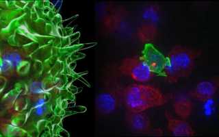 Моноклональные антитела при псориазе