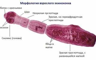 Что важно знать об эхинококкозе у человека