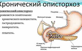 Описторхоз: схема лечения взрослого человека