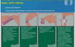 Паровые ингаляции при кашле, насморке и бронхите. Рекомендации врачей, можно ли делать ингаляции при температуре и какие